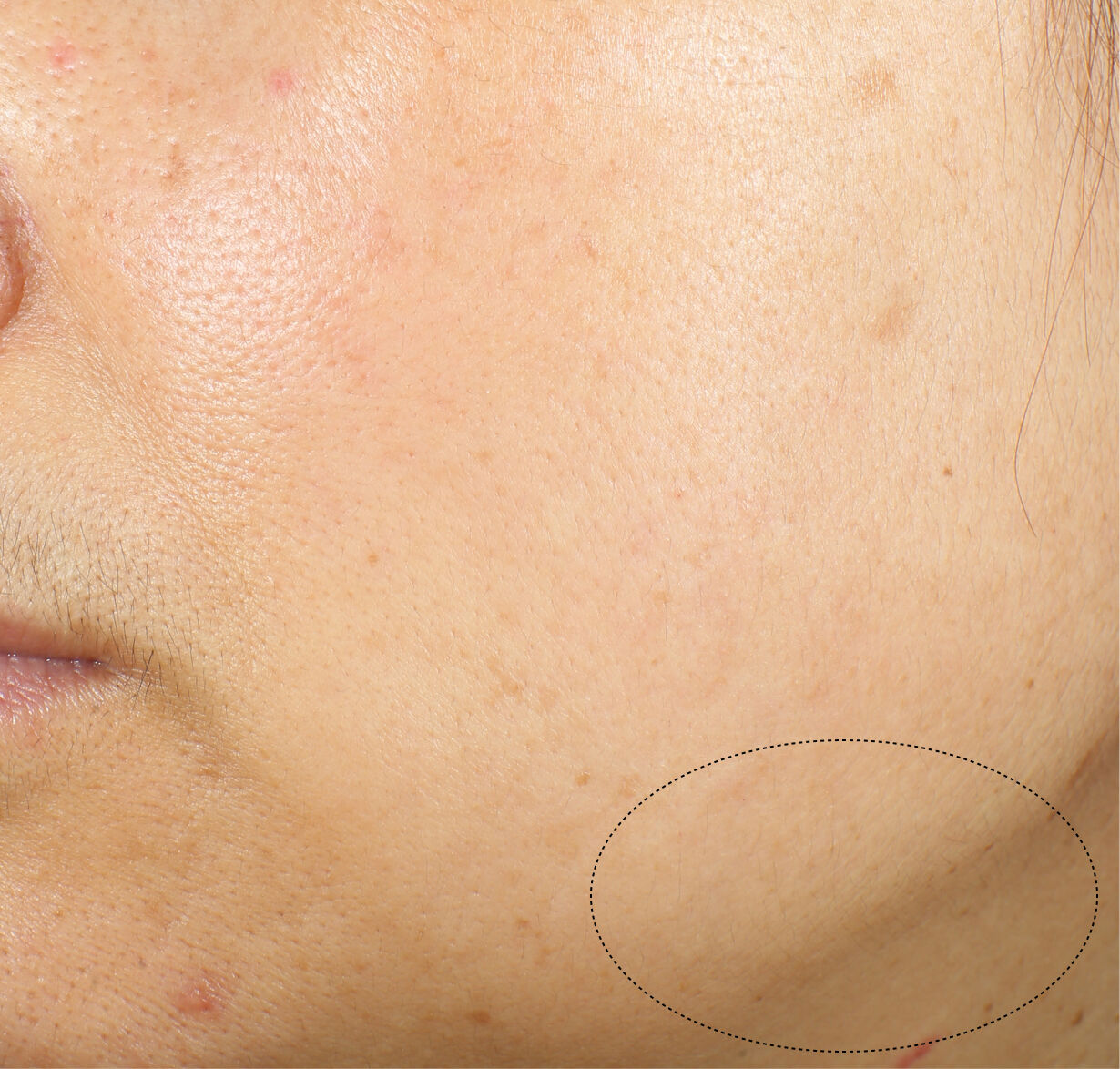 Crème lift et raffermissant intensive,