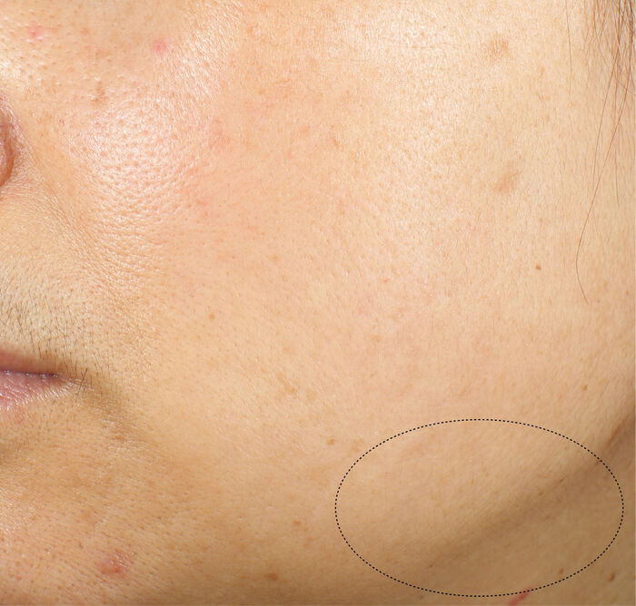 Uplifting and Firming Advanced Cream, 