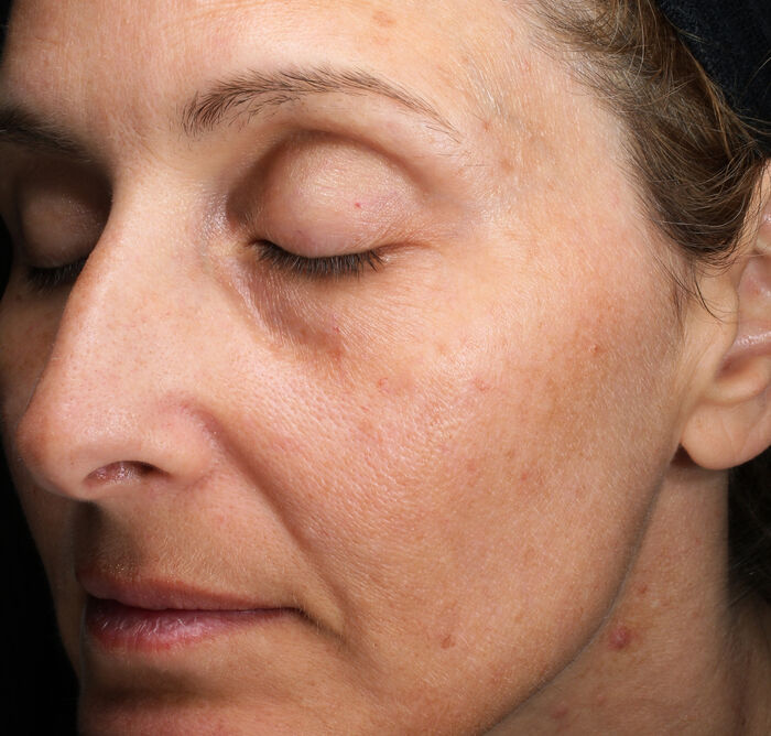 Crème régénératrice contour des yeux et des lèvres,