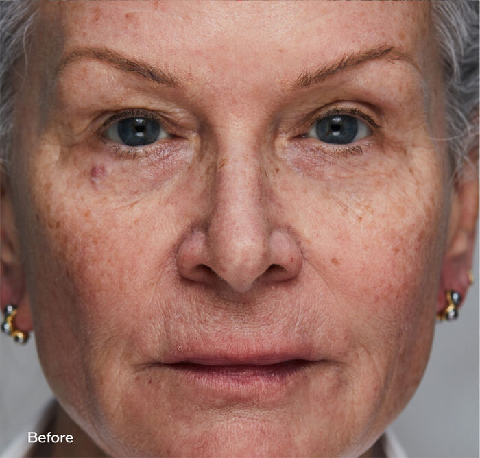 Sérums Skin Filler,