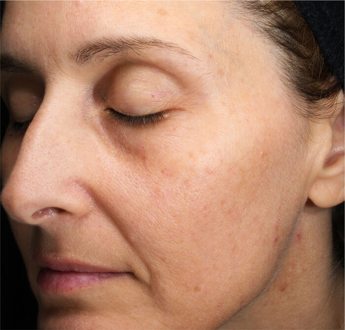 Crème régénératrice contour des yeux et des lèvres,