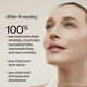 Intensive WrinkleSpot Treatment A+, 