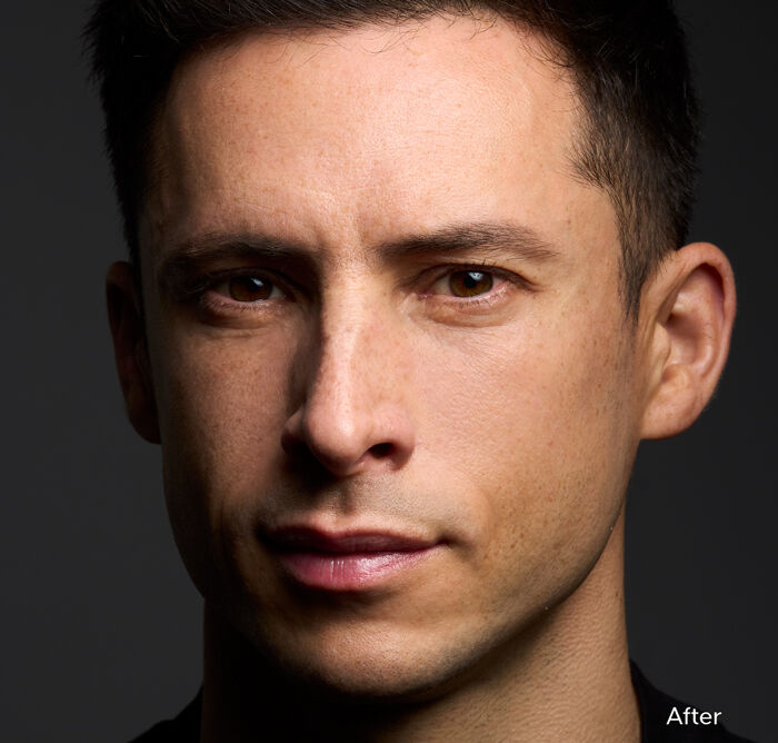 Ultimune Power Infusing Serum, 