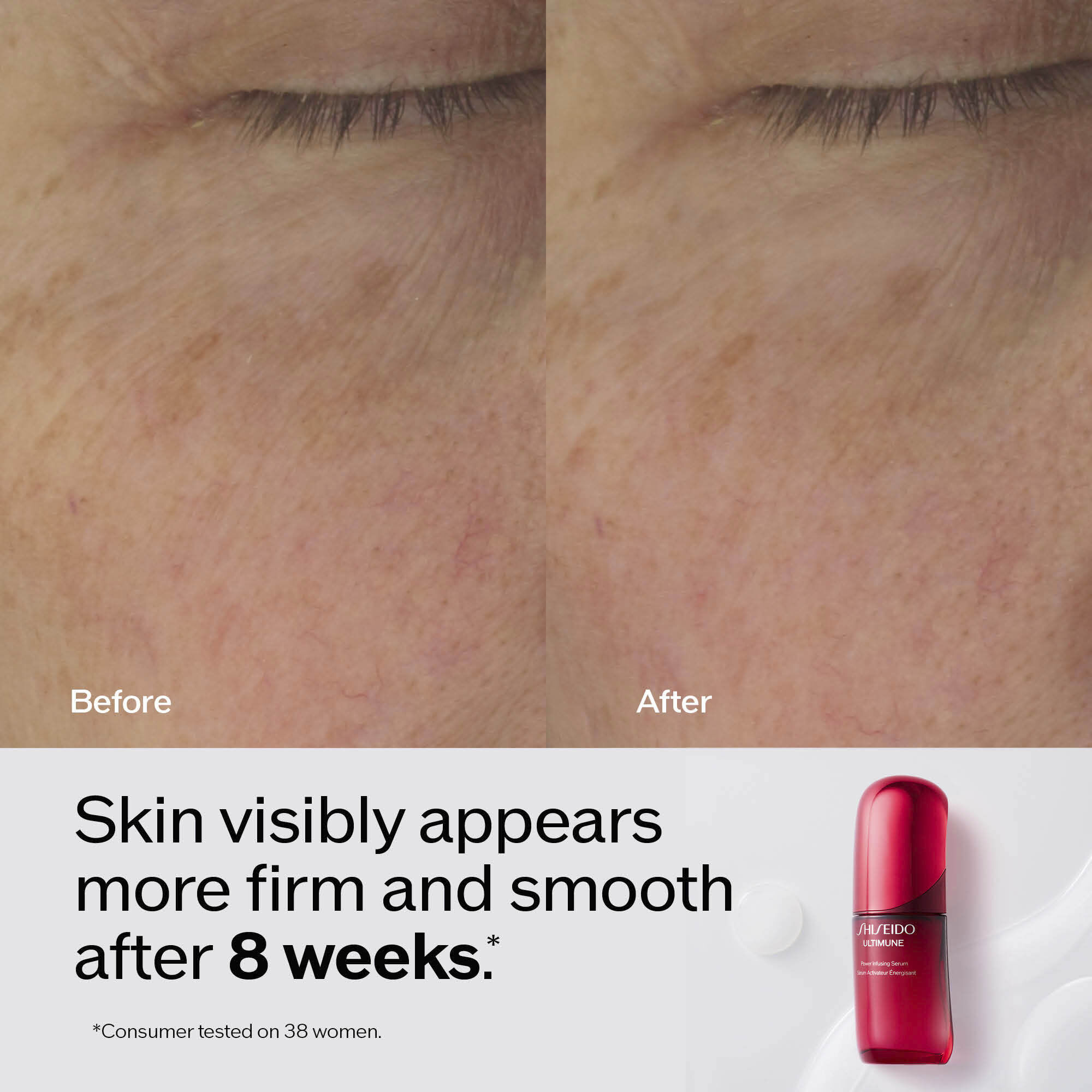 A split image shows a 'before' close-up of skin with wrinkles and sunspots next to an 'after' close-up of noticeably smoother skin with reduced wrinkles and spots. Below, a red Shiseido Ultimune serum bottle accompanies the text: 'Skin visibly appears more firm and smooth after 8 weeks.'