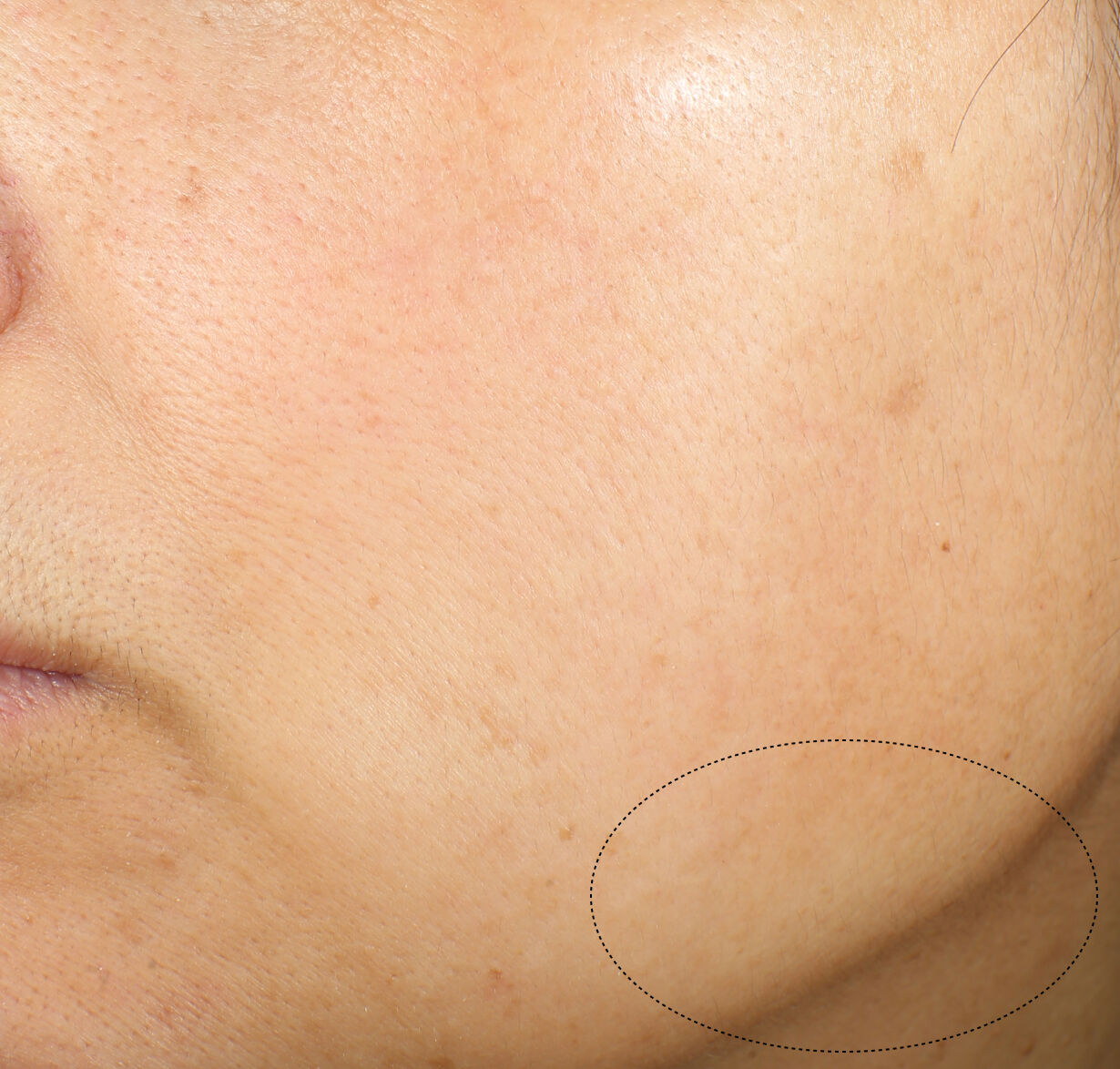 Crème lift et raffermissant intensive,